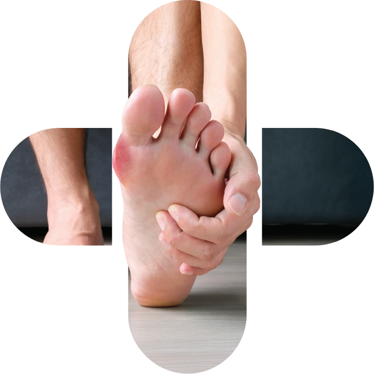 usecase-gout-image Products US